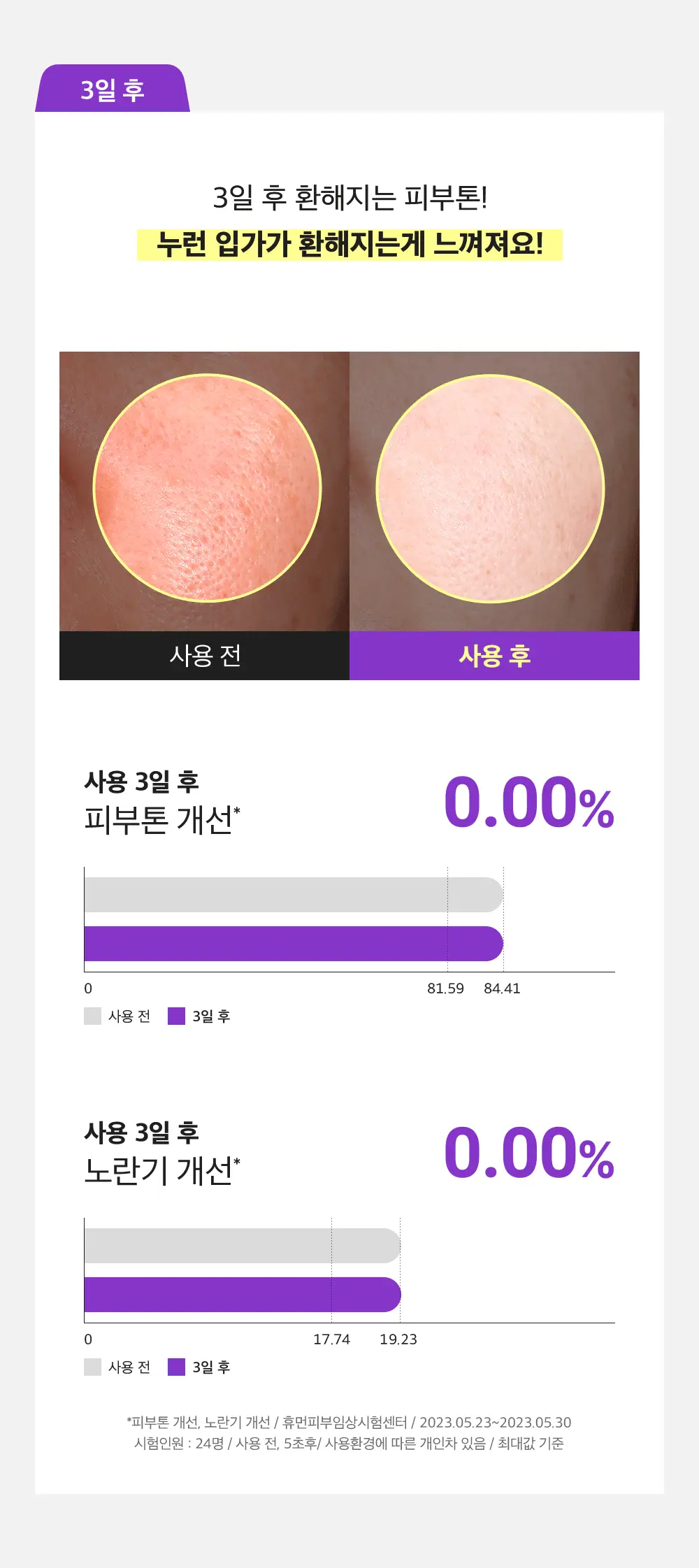 [잡티미백케어] 성분에디터 머루포도 비타씨 다크 스팟 앰플 40ml 더블기획 상세페이지 18